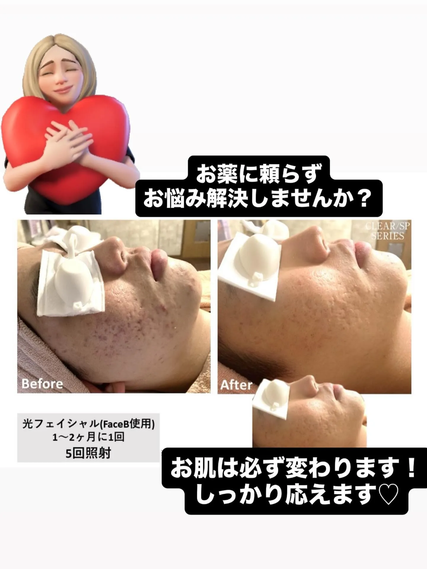 その肌悩み、ゆらぎ肌ではありませんか?🙈